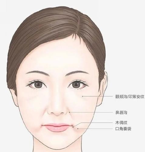 米揚麗格馬平山醫生采用PLLA艾維嵐在口周年輕化方面的成果(圖6)