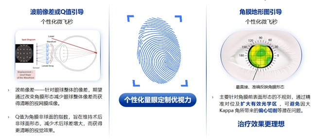 鄭州普瑞丨量眼定制獨一無二的清晰，個性化近視手術(shù)，為您提供極致的視覺體驗！(圖2)