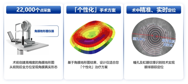 鄭州普瑞丨量眼定制獨一無二的清晰，個性化近視手術(shù)，為您提供極致的視覺體驗！(圖3)
