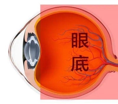 愛爾眼科：激光“打”在眼內還能治眼病？